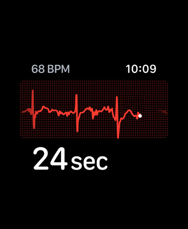 App ECG, battements par minute en haut à droite, tracé, compte à rebours
